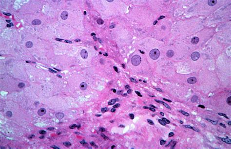 HLS [ Female Reproductive System, ovary, corpus luteum, granulosa lutein and theca lutein cells ...