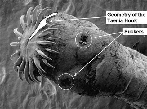 Taenia Solium Scolex Parts