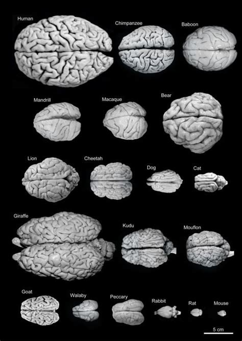 Comparative brain anatomy... : r/medizzy