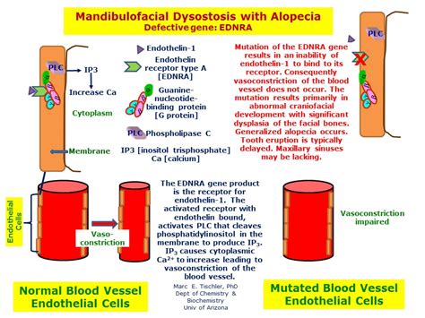 Mandibulofacial Dysostosis with Alopecia | Hereditary Ocular Diseases