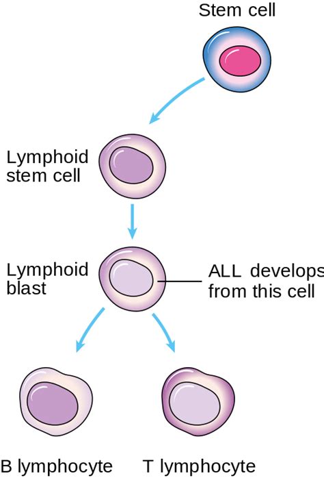 Acute Lymphoblastic Leukemia (ALL) — Survival Rate and Therapy