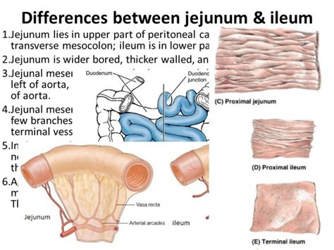 11 Crucial Difference between Jejunum and Ileum with Table - Core ...