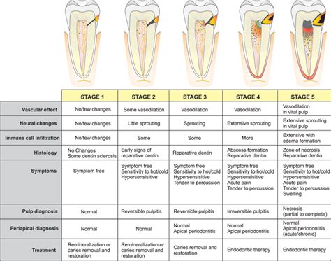 Referred Tooth Pain Chart - Best Picture Of Chart Anyimage.Org