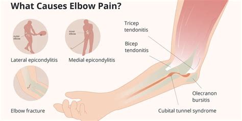 Elbow Pain: Causes, Symptoms, Diagnosis, and Treatment | HealthNews