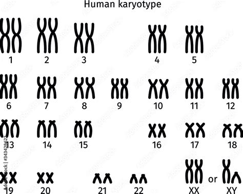 Vettoriale Stock Scheme of normal karyotype of human somatic cell 46XX ...