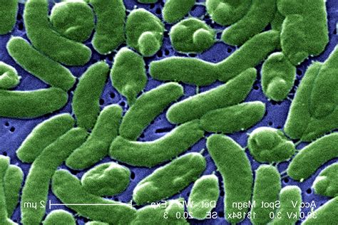 Free picture: grouping cells, vibrio vulnificus, bacteria, photomicrograph