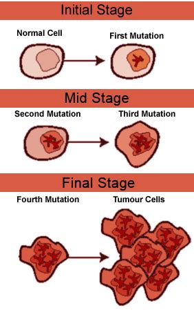 Leukemia