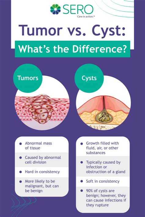 Difference Between Cyst And Tumor Features Causes