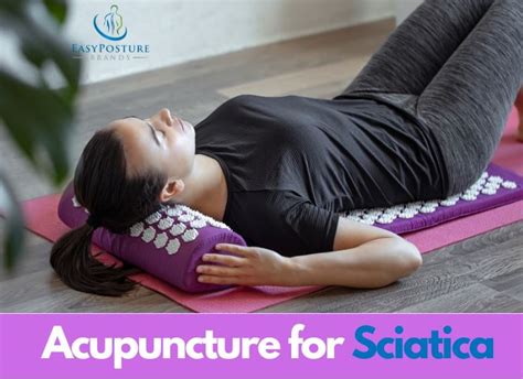 Acupuncture for Sciatica - Best Guide for Nerve Pain Relief - Easy Posture Brands