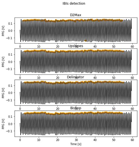 Beat detection — Signal Processing and Learning for Wearables