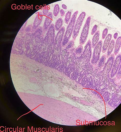 jejunum Histology.