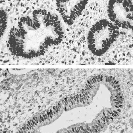 Activation of the progesterone receptor (PR) by progesterone receptor... | Download Scientific ...