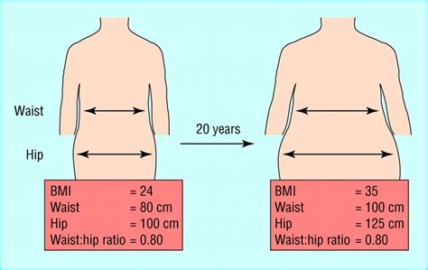 Treatment of obesity: need to focus on high risk abdominally obese ...