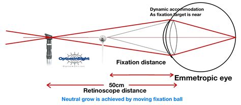 Bell retinoscopy - OptomInSight