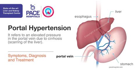 Best Hospital in Hyderabad : Pace Hospitals