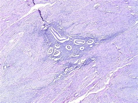 Webpathology.com: A Collection of Surgical Pathology Images