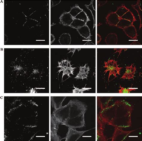 Uptake and trafficking of LL-37 in A549 epithelial cells. A549 cells ...