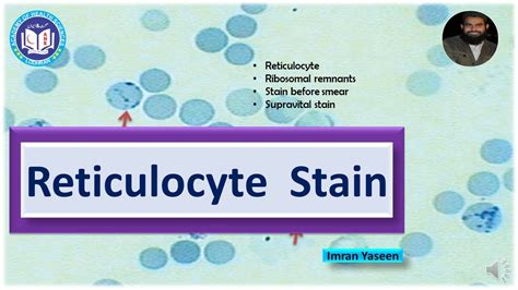 Reticulocyte Supravital Stain