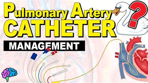 PA Catheter Management - YouTube