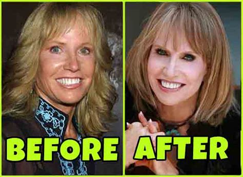 What happened to Monica Quartermaine (Leslie Charleson) on General Hospital? Know Her Age, Net ...