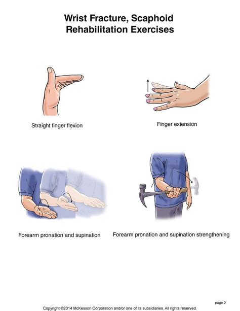 Summit Medical Group - Wrist Fracture, Scaphoid: Rehabilitation ...