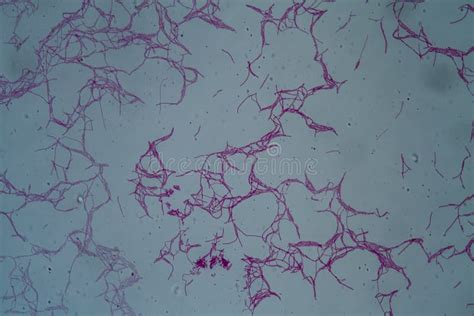 Bacillus Anthracis Anthrax 200x Stock Image - Image of bacillus, germs ...