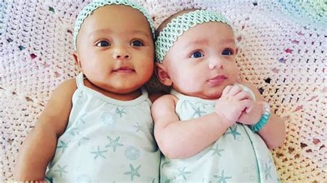 Twin baby girls from Illinois born with different skin colors | fox61.com