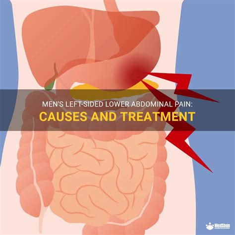 Men's Left-Sided Lower Abdominal Pain: Causes And Treatment | MedShun