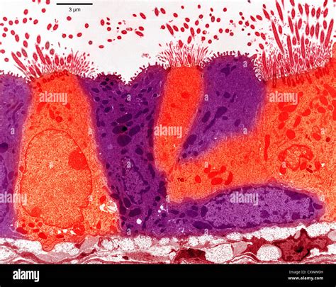 Lung epithelium hi-res stock photography and images - Alamy