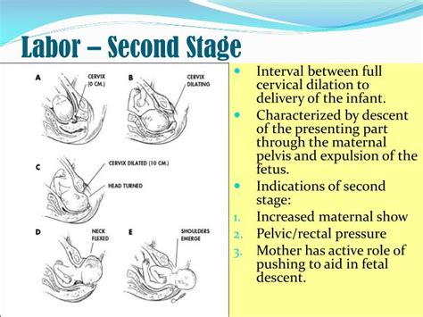 Second Stage Of Labour / PPT - The Second Stage of Labour PowerPoint ...