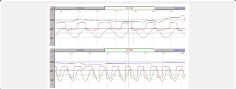 Smooth pursuit test results. Upper: The horizontal pursuit test... | Download Scientific Diagram