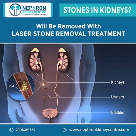 Gallery | Nephron Kidney Centre