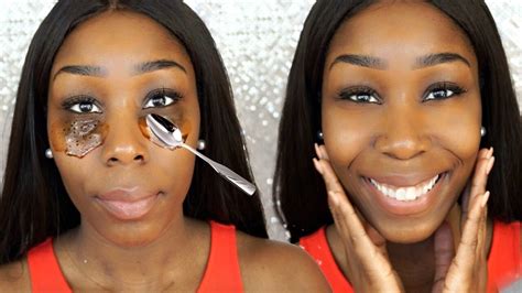 DIY: How To Get Rid Of Dark Circles and Bags Under Eyes Fast! - YouTube