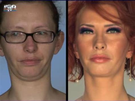 Successful Plastic Surgery (31 pics) - Izismile.com