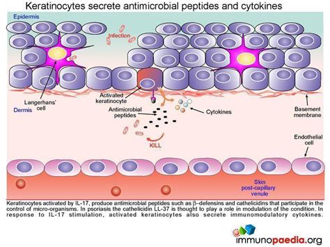 Severe Psoriasis vulgaris Case Study | Immunopaedia