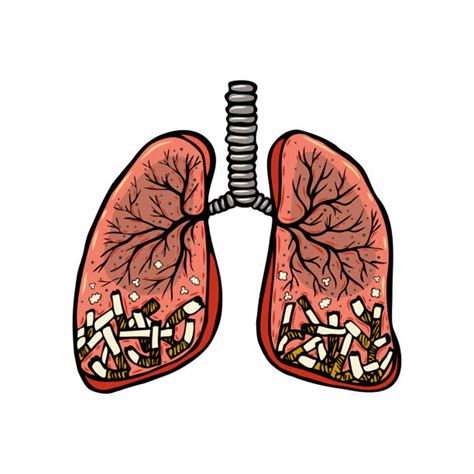 Lungs Smoker Drawing Illustrations, Royalty-Free Vector Graphics & Clip ...