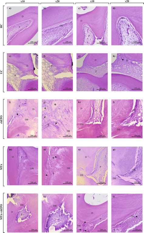 Histology of rat pulps at day 28 post capping stained with... | Download Scientific Diagram