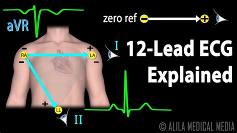 12 Lead ECG Explained, Animation - YouTube