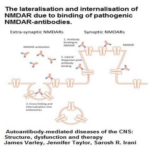 Anti-NMDAr Encephalitis | Brain Inflammation Symptoms & Treatments