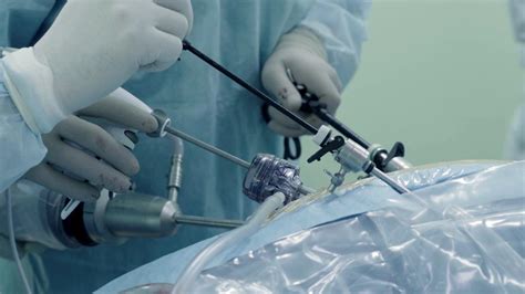 Laparoscopy (pelvic): Uses, risks, and benefits