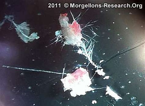 morgellons microscopic pictures photos fibers gmo pics