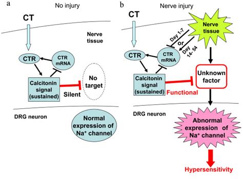 Possible mechanisms for the inhibition by calcitonin of the abnormal ...