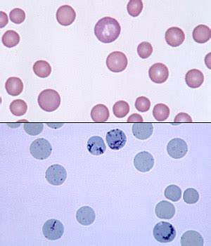 Feline reticulocytes | eClinpath