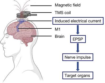 Frontiers | Clinical application of transcranial magnetic stimulation in multiple sclerosis