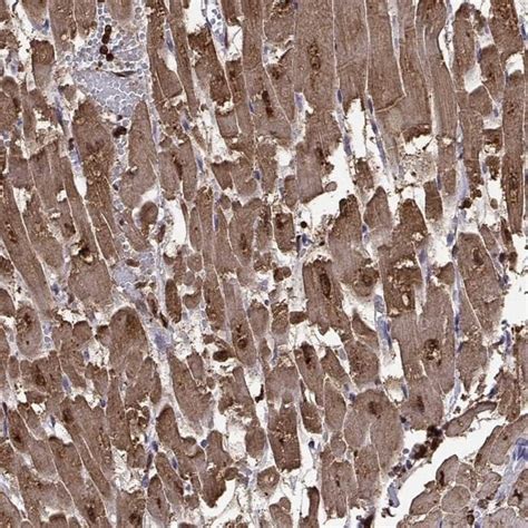 Cardiac Troponin C Polyclonal Antibody, Invitrogen 100 μL; Unconjugated ...