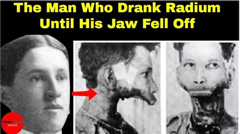 The Man Who Drank Radium Until His Jaw Fell Off | Eben Byers | True Crime Diaries - YouTube