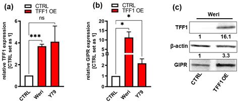 Cancers | Free Full-Text | Gastric Inhibitory Polypeptide Receptor (GIPR) Overexpression Reduces ...