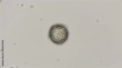 shell of Testacea amoeba Difflugia class lobostoma top view of the shell,which is assembled from ...