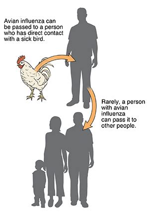 Bird Flu (Avian Influenza) | Saint Luke's Health System