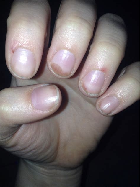 Hair dye stained fingernails :( can anybody help? Not sure where else to post. : RedditLaqueristas